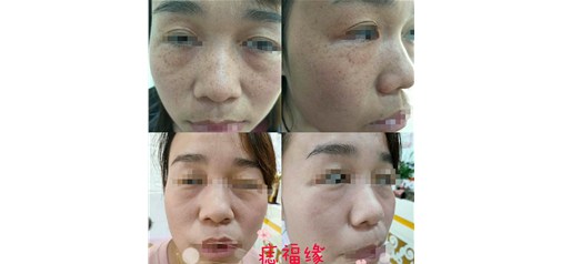 痣福缘雀斑中心：你若安好，一切都好！